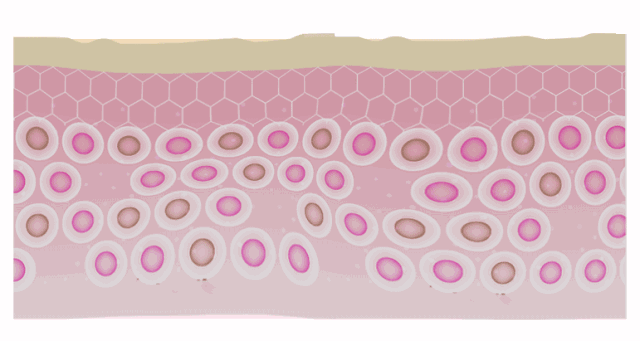手脚脱皮干裂泰国古方一抹见效3天奇迹修复帮你轻松找回白嫩好皮肤