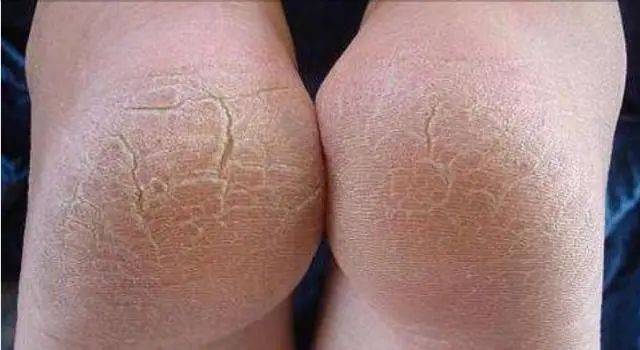 夏季囧事仙女的汗脚