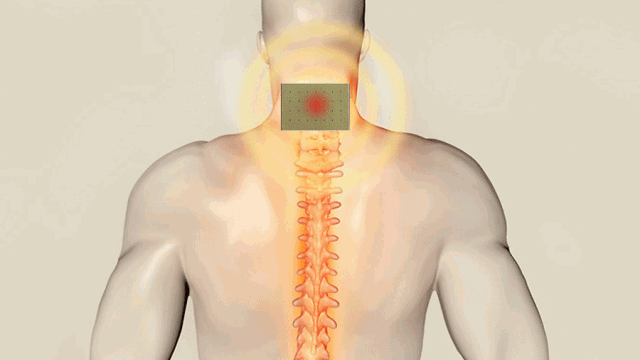 肩颈酸痛忍无可忍?贴一贴它,驱寒祛湿,活血通络,哪痛贴哪!